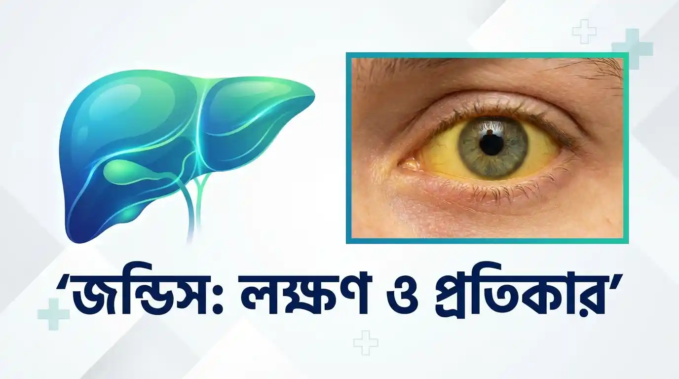 জন্ডিস কী এবং এর লক্ষণ ও প্রতিকার সহজ ভাষায়